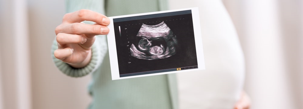 USG ciąży w&nbsp;Warszawie