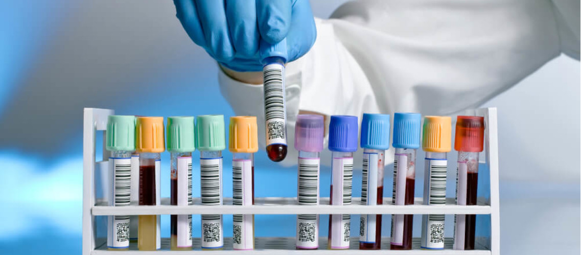 cea warszawa gdzie zrobić