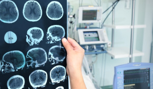 neurochirurgia warszawa szpital damiana