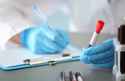 HPV DNA 2 high-oncogenic genotypes 16, 18 qualitatively