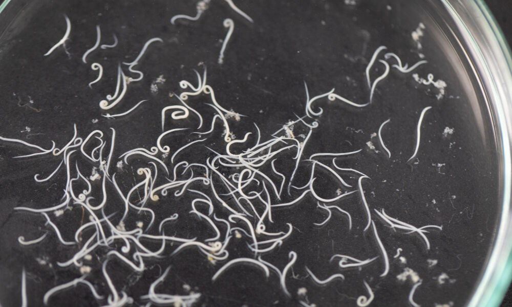 Glisty ludzkie w&nbsp;powiększeniu mikroskopem