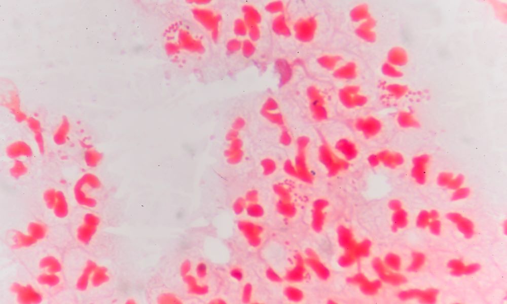 Bakteria rzeżączki w&nbsp;przybliżeniu