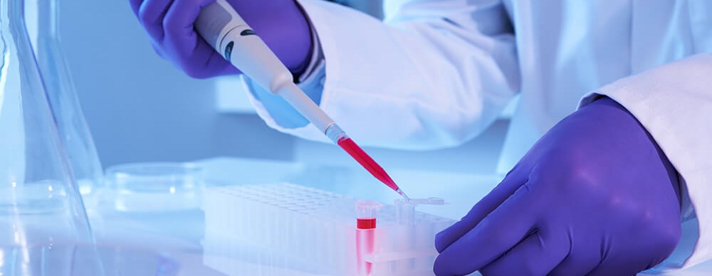 Komórki macierzyste w&nbsp;ortopedii 