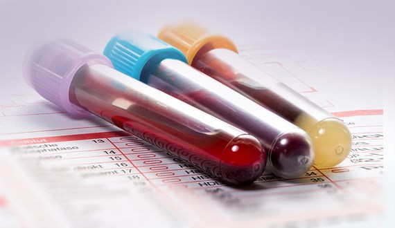 Laboratory diagnostics