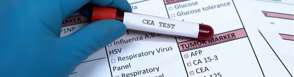 badanie cea warszawa