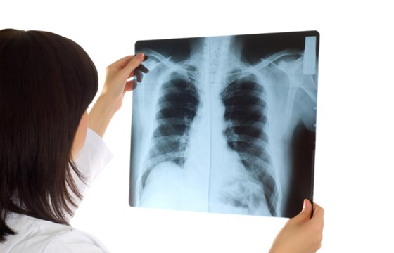 <strong>BADANIA RTG</strong>