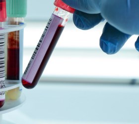 badania laboratoryjne