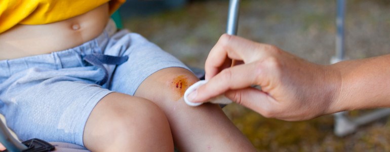 tężec przyczyny objawy szczepienie