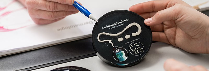 Tasiemiec - czym jest i&nbsp;jakie choroby powoduje?